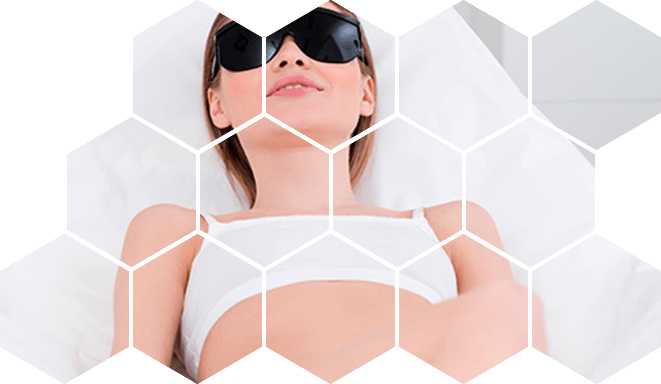 Лазерная эпиляция