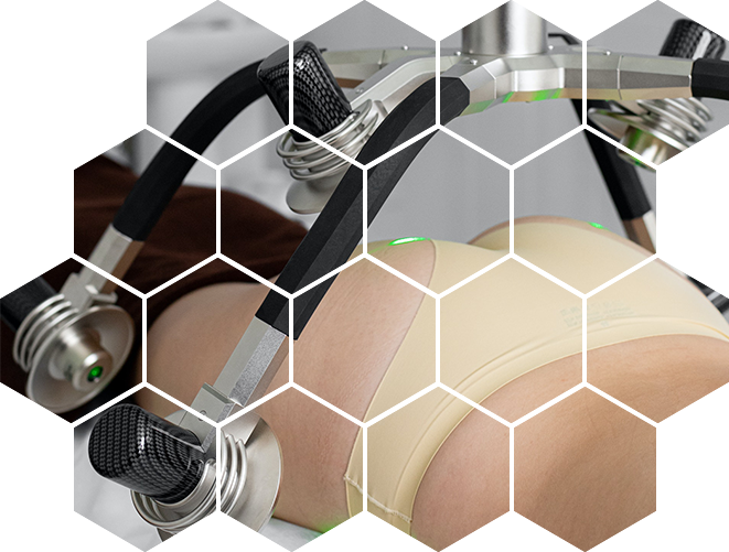 Аппаратная коррекция фигурыАппаратная коррекция фигуры